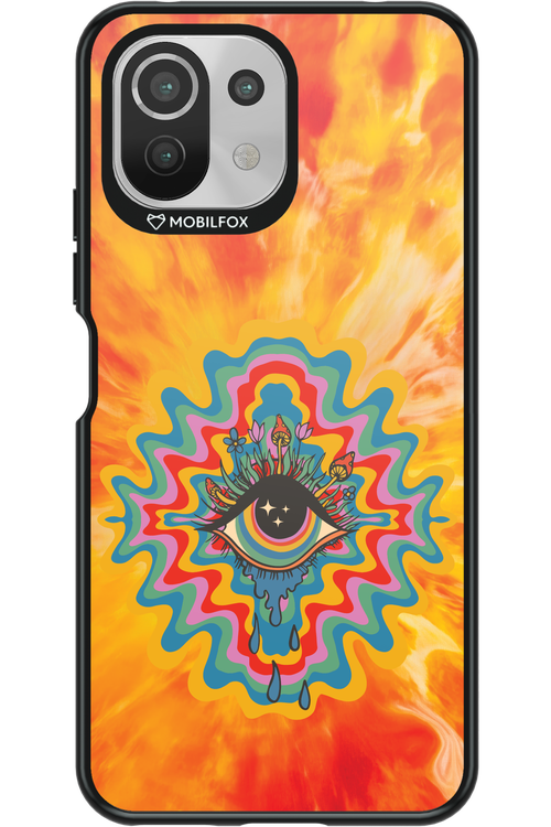 ThirdEye 2.0 - Xiaomi Mi 11 Lite (2021)