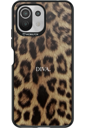 Diva 2.0 - Xiaomi Mi 11 Lite (2021)