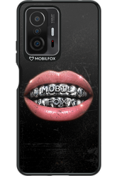 MOBILFOX GRILL 2.0 - Xiaomi Mi 11T Pro