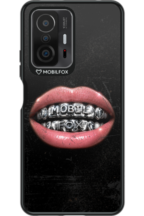 MOBILFOX GRILL 2.0 - Xiaomi Mi 11T Pro