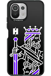 KING - Xiaomi Mi 11 Lite (2021)