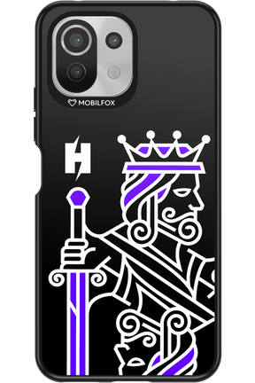 KING - Xiaomi Mi 11 Lite (2021)