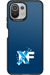 Nano Burst  - Xiaomi Mi 11 Lite (2021)