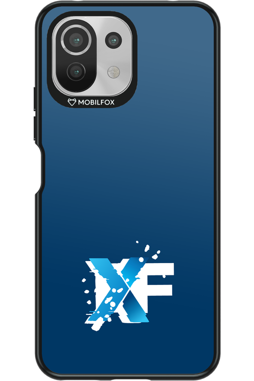 Nano Burst  - Xiaomi Mi 11 Lite (2021)