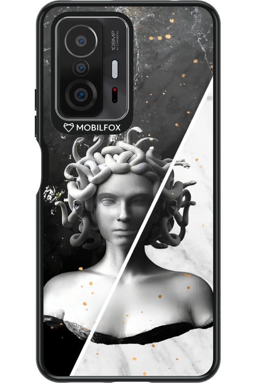 Medusa - Xiaomi Mi 11T Pro