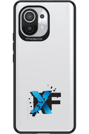 Reflex Spark - Xiaomi Mi 11 5G