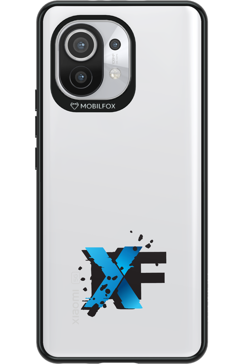 Reflex Spark - Xiaomi Mi 11 5G