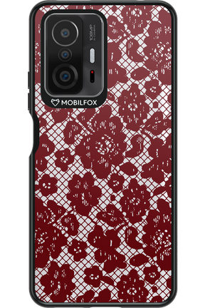 Lace Lover - Xiaomi Mi 11T