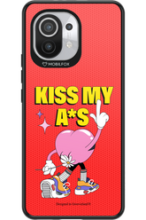 KISS - Xiaomi Mi 11 5G