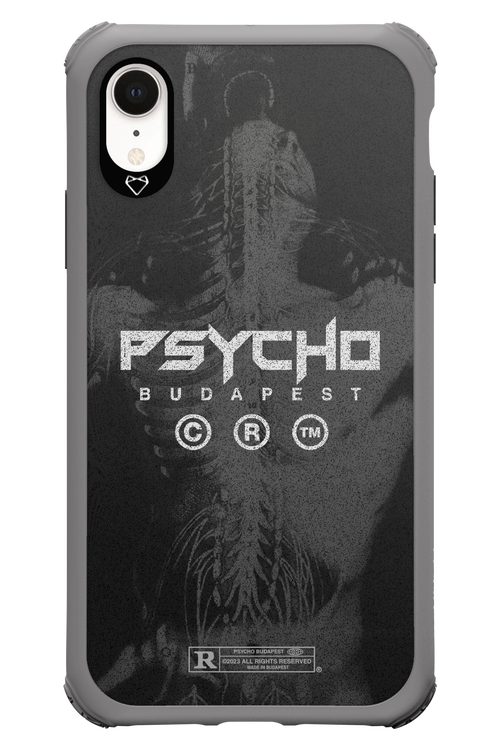 X-Ray - Apple iPhone XR