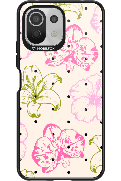 Aloha Chic 2.0 - Xiaomi Mi 11 Lite (2021)