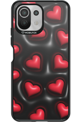 Hearts in love - Xiaomi Mi 11 Lite (2021)