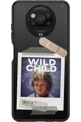 Wild Childd - Xiaomi Poco X3 NFC