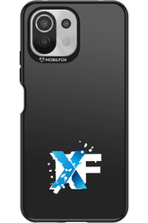 Impact Core - Xiaomi Mi 11 Lite (2021)