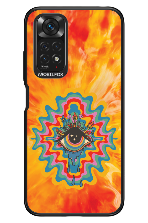 ThirdEye 2.0 - Xiaomi Redmi Note 11/11S 4G