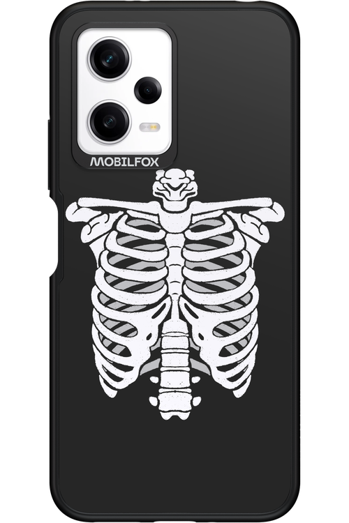 SKELETON - Xiaomi Redmi Note 12 5G