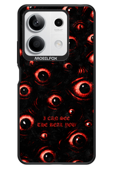 The Watchers - Xiaomi Redmi Note 13 5G