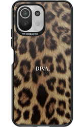 Diva - Xiaomi Mi 11 Lite (2021)