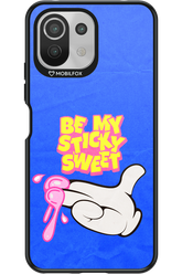 be my sticky sweet 2.0 - Xiaomi Mi 11 Lite (2021)
