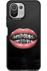 MOBILFOX GRILL 2.0 - Xiaomi Mi 11 Lite (2021)
