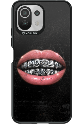 MOBILFOX GRILL 2.0 - Xiaomi Mi 11 Lite (2021)