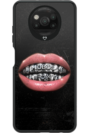 MOBILFOX GRILL 2.0 - Xiaomi Poco X3 Pro
