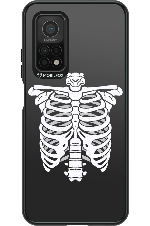 SKELETON - Xiaomi Mi 10T 5G