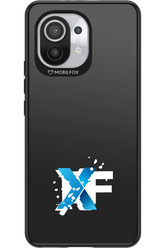 Impact Core - Xiaomi Mi 11 5G