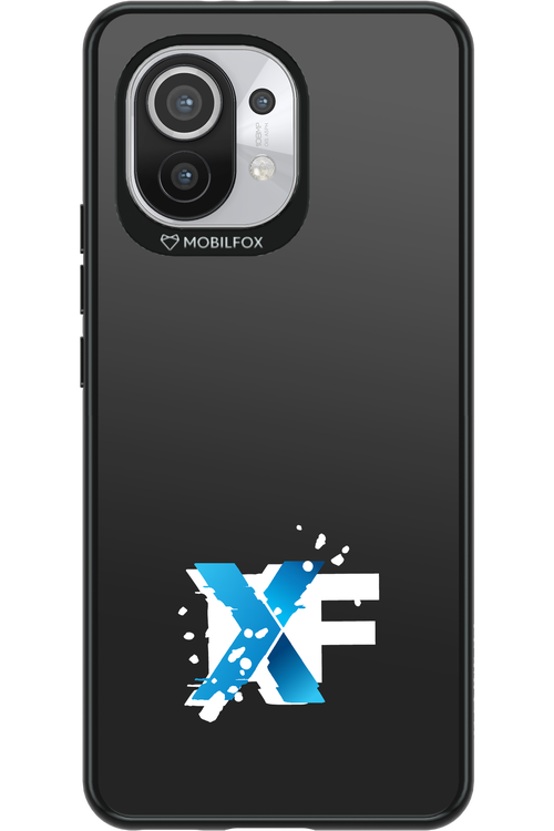 Impact Core - Xiaomi Mi 11 5G