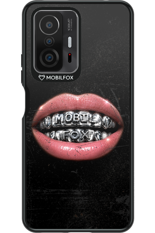 MOBILFOX GRILL 2.0 - Xiaomi Mi 11T