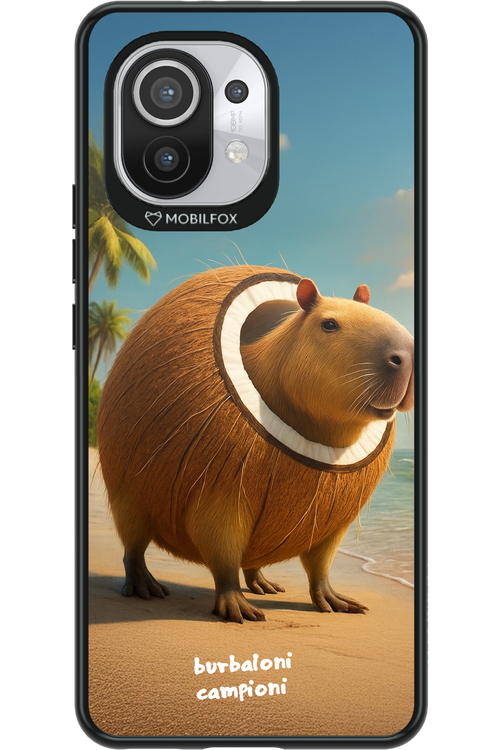 Burbaloni campioni - Xiaomi Mi 11 5G